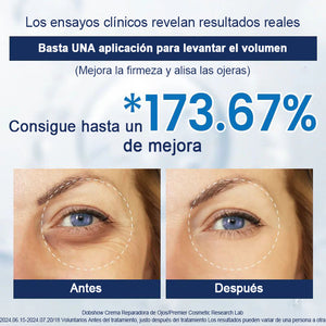 Crema para eliminar las bolsas de los ojos 🎁Compra 1 y llévate 1 gratis (2 unidades)🎁