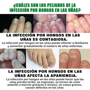 Cuidado de las uñas con jengibre