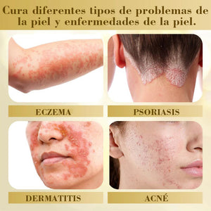 Crema reparadora de la piel Condense Mellifera Venom