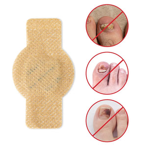 Pegatinas para la onicomicosis