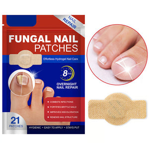 Pegatinas para la onicomicosis