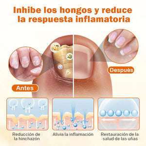 Spray reparador de uñas con veneno de abeja