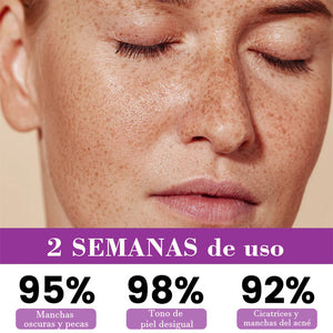 Suero antipigmentación avanzado
