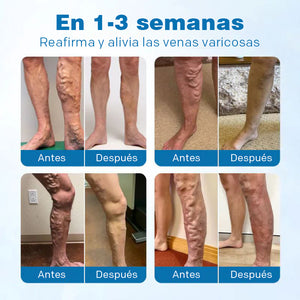 Solución para el cuidado de los pies