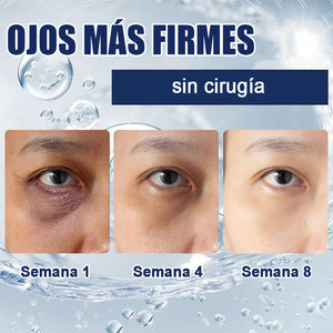 Crema para eliminar las bolsas de los ojos 🎁Compra 1 y llévate 1 gratis (2 unidades)🎁