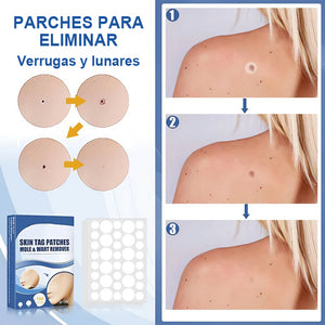 Pegatina para eliminar verrugas y lunares (compre 1 y obtenga 1 gratis)
