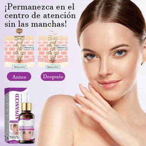 Suero antipigmentación avanzado