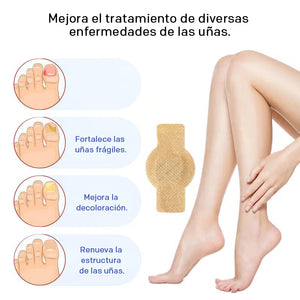 Pegatinas para la onicomicosis
