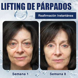 Crema para eliminar las bolsas de los ojos 🎁Compra 1 y llévate 1 gratis (2 unidades)🎁