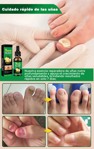 Cuidado de las uñas con jengibre