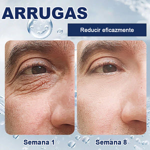 Crema para eliminar las bolsas de los ojos 🎁Compra 1 y llévate 1 gratis (2 unidades)🎁