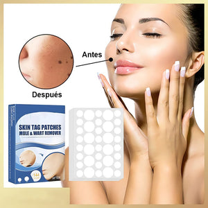 Pegatina para eliminar verrugas y lunares (compre 1 y obtenga 1 gratis)