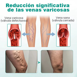 Parche para venas varicosas