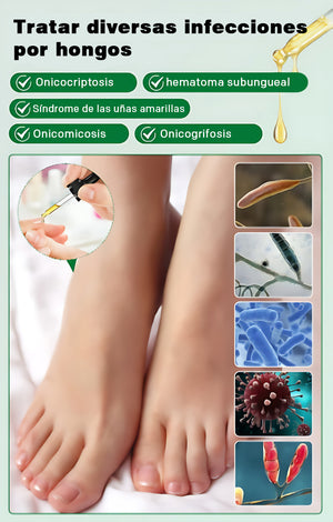 Cuidado de las uñas con jengibre