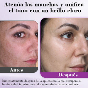 Suero antipigmentación avanzado