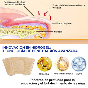 Pegatinas para la onicomicosis
