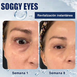Crema para eliminar las bolsas de los ojos 🎁Compra 1 y llévate 1 gratis (2 unidades)🎁