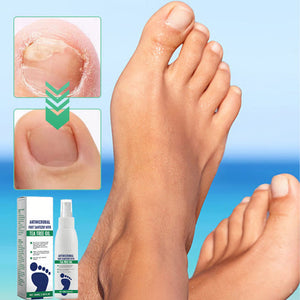 Spray para el cuidado de los pies