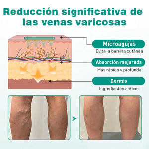 Parche para venas varicosas