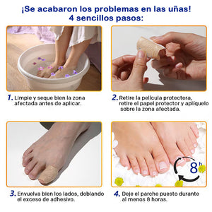 Pegatinas para la onicomicosis