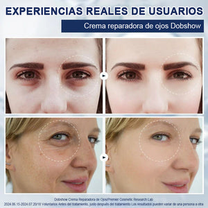 Crema para eliminar las bolsas de los ojos 🎁Compra 1 y llévate 1 gratis (2 unidades)🎁