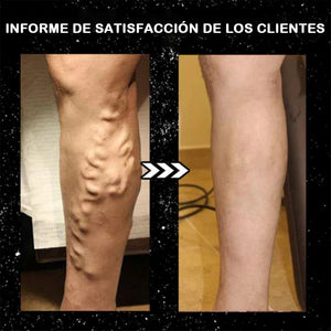 Calcetines de iones de turmalina