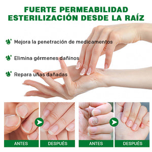 Cuidado de las uñas con jengibre