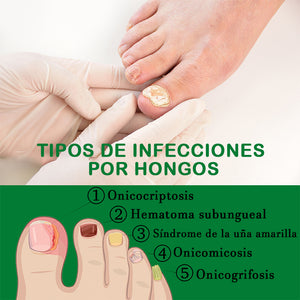 Cuidado de las uñas con jengibre