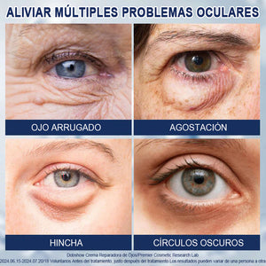 Crema para eliminar las bolsas de los ojos 🎁Compra 1 y llévate 1 gratis (2 unidades)🎁