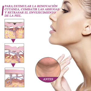Crema Renovadora de Colágeno Hidrolizado para el Cuello (COMPRE UNO LLÉVESE OTRO GRATIS (2UD) )