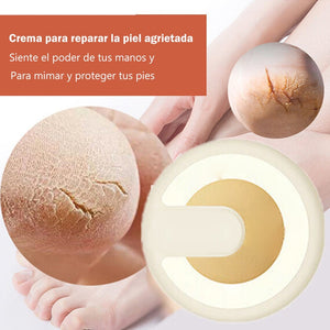 Crema anti-grietas para reparar la piel agrietada