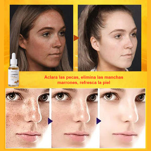 Suero reparador de manchas de cúrcuma - COMPRE 1 Y RECIBA 1 GRATIS (2 PIEZAS)