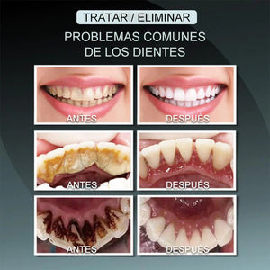 Espuma limpiadora de dientes con aceite de coco