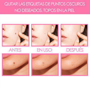 Suero purificador de manchas de piel orgánico