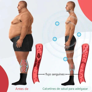 Calcetines de fitness autocalentables de acupresión con turmalina
