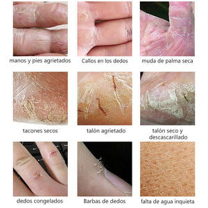 Crema anti-grietas para reparar la piel agrietada