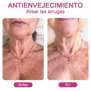 Crema Renovadora de Colágeno Hidrolizado para el Cuello (COMPRE UNO LLÉVESE OTRO GRATIS (2UD) )