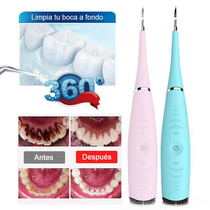 Limpiador de Dientes Ultrasónico