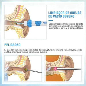 Aspirador Removedor de Cera del Oído