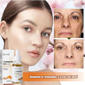 Suero reparador de manchas de cúrcuma - COMPRE 1 Y RECIBA 1 GRATIS (2 PIEZAS)