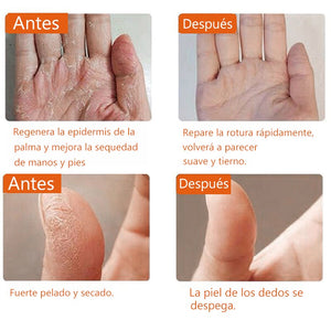Crema anti-grietas para reparar la piel agrietada