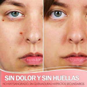 Suero purificador de manchas de piel orgánico