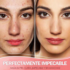 Suero purificador de manchas de piel orgánico